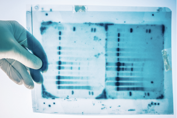 Person holding gel electrophoresis image DNA